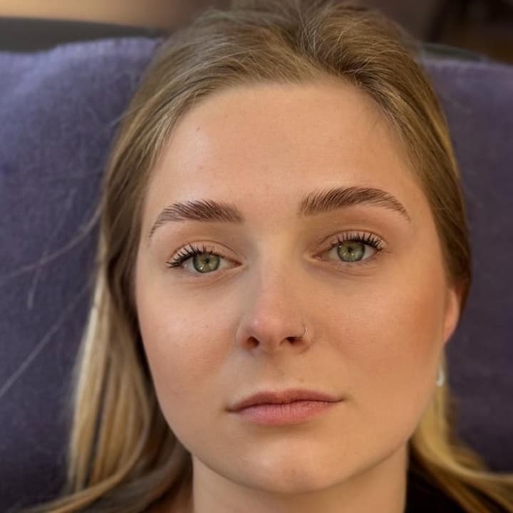BrowLift